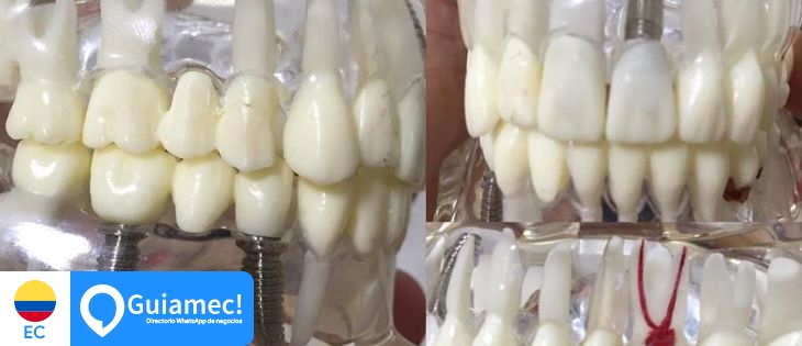 Dental Care Center en Guayaquil