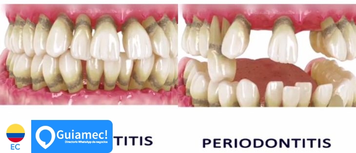 Odontológico, blanqueamiento, Dental care en Guayaquil