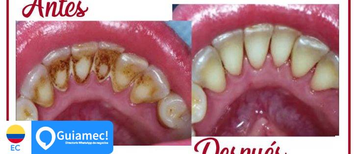 GS Dental en Guayaquil