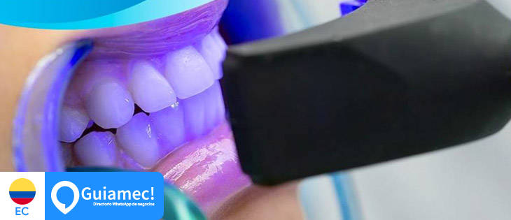 ortodoncia Guayaquil , blanqueamiento dental Guayaquil , limpieza dental Guayaquil  en Guayaquil