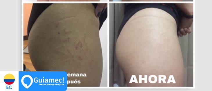 Vien Estética Integral en Quito