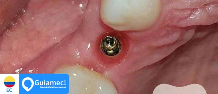 Clinica dental en Tamiallacta - Quito  en Quito