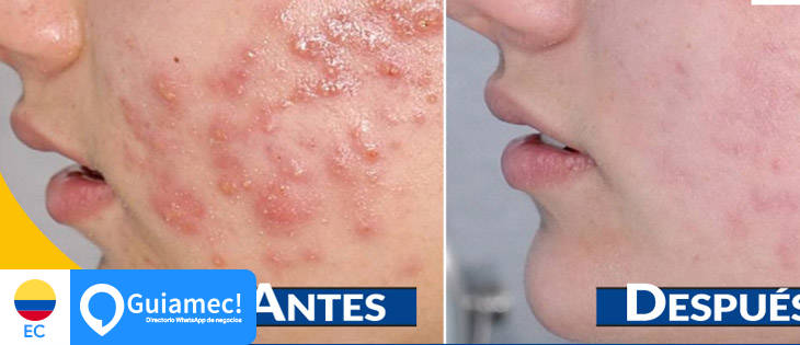 Dermatológico Loayza en Guayaquil