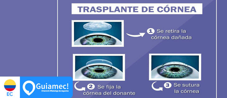 oftalmología Machala, cirugía oftalmología Machala, oftalmología  en Machala