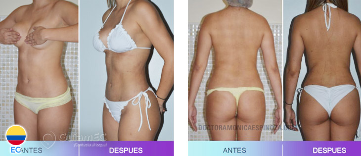 Mónica Espinoza en Guayaquil