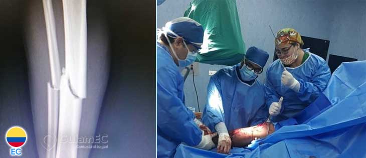 Traumatólogo ortopedista en Guayaquil