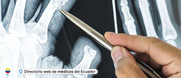 traumatología guayaquil, traumatólogo guayaquil, ortopedia guayaquil, ortopédico guayaquil en Guayaquil